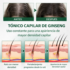 SPRAY PARA CRECER EL CABELLO OUHOE
